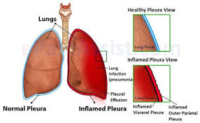 Pin On Health