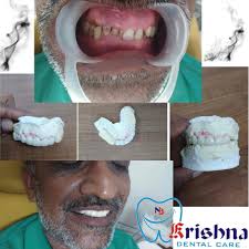 Dr Navnit K.Thummar (Krishna Dental Care) in Mota Varachha,Surat