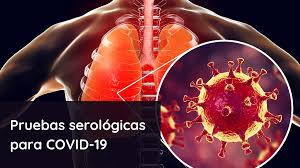 Esta gran diversidad de anticuerpos humano permite al sistema. Generalidades Sobre Las Pruebas Serologicas Para La Deteccion De Anticuerpos Sars Cov 2 Laboratorio Bolivar