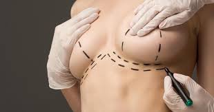 Bruststraffung Focus Arztsuche