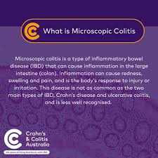 Image result for Microscopic Colitis