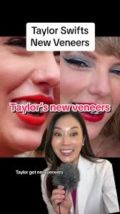 Taylor Swift Buck Teeth