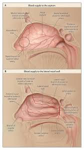 Image result for Epistaxis