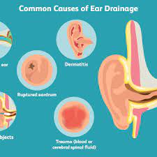 To identify the causes of blood from the ear and determine what to do next, you need to consult a qualified physician. Causes And Treatment For Ear Drainage