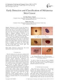 During medical examination your doctor will ask about symptoms, risk factors such as family history of skin cancer or sunburn and examine your skin to look for signs that may indicate melanoma. Pdf Early Detection And Classification Of Melanoma Skin Cancer