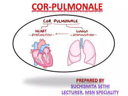 Image result for Cor Pulmonale