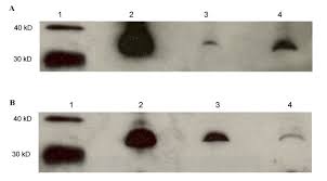 2000 x 1000 jpeg 328kb. Bio F 1 B Hamster A Unique Animal Model With Reduced Lipoprotein Lipase Activity To Investigate Nutrient Mediated Regulation Of Lipoprotein Metabolism Nutrition Metabolism Full Text