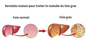 Pin On Foie