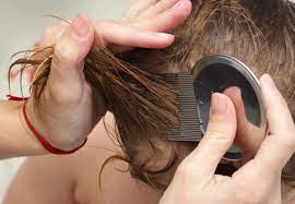 Nits are lice eggs stuck to the hair shaft, and white, flaky dandruff is mostly on the scalp. The 4 Head Lice Facts That Every Parent Needs To Know Health Essentials From Cleveland Clinic