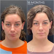 Todd Hanna, MD, DDS, FACS (@doctor.hanna) • Instagram photos and videos