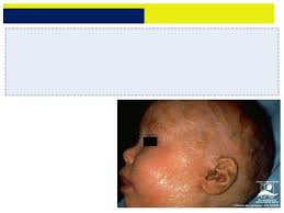 Grátis: Desenvolvimento do Sistema Tegumentar