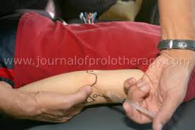 Image result for Elbow Joint Injection