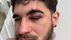 Fundraiser by Steven Carper : Support Recovery After Severe Accident