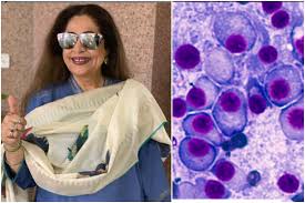 Cancer is remarkably noted with an unexplained weight loss with severe loss of appetite. All About Multiple Myeloma Type Of Blood Cancer Kirron Kher Is Suffering From