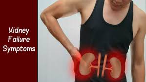 Kidney Failure Symptoms Gurda Kharab Hone Ke Lakshan