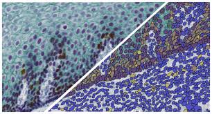 Multiplex IHC - Indica Labs
