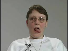 Image result for Rapid Alternating Movements