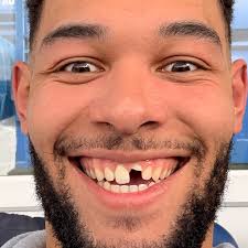 Fundraiser by Leanne Smith : DJ's Dental Disaster!!