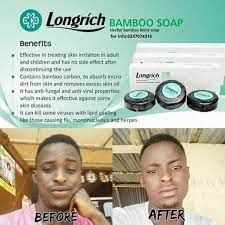 Maybe you would like to learn more about one of these? Longrich Bamboo Charcoal Soap Longrich Benin City Facebook