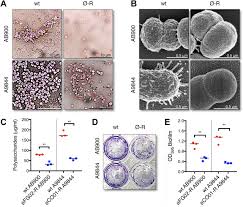 Image result for Striga baumannii