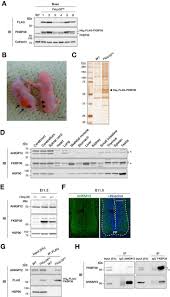 When qiao moyu awakened, she found herself in a novel world and had become the villainess who was loathed by the president, the story's male protagonist.qiao moyu, the president's childhood friend, ca. Role Of The Ankmy2 Fkbp38 Axis In Regulation Of The Sonic Hedgehog Shh Signaling Pathway Journal Of Biological Chemistry