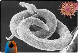 Image result for Helminth