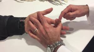 Image result for Elson Extensor Tendon Test