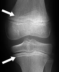 Human Anatomy Flashcards | Quizlet