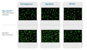 Image result for ANA Staining Pattern