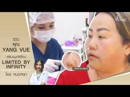 คุณ Yang Vue ได้มาเสริมทรงจมูก ซิลิโคน Limited by Infinity ที่วาโย คลินิก  กับหมอหยก