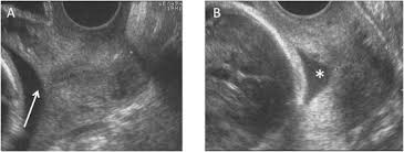 We did not find results for: The Structure And Function Of The Cervix During Pregnancy Sciencedirect