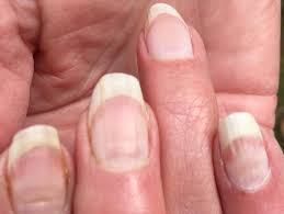 This horizontal line can be a dynamic one that will change its value or a line with a fixed value. Covid Nails Could Be Sign Of Previous Infection Expert Says