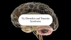 Image result for Tic Disorder
