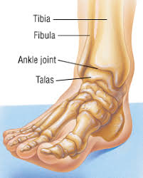 A medial malleolus fracture can include impaction or indenting of the ankle joint. Ankle Fracture Harvard Health