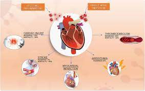 Reports of heart inflammation among small number of children that got pfizer vaccine. Cardiovascular Disease In Covid 19