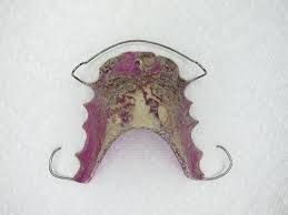 Soak your retainer for at least 20 minutes in the solution. How To Clean A Crusty Retainer Invisalign Or Orthodontic