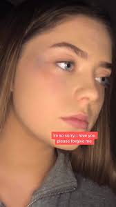 Escaping a Toxic Relationship Experience in Australia