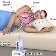 Image result for Pleiotaxis