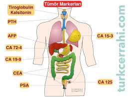 Lenf sistemi yani lenfatik sistemin salgı bezleri ve salgı düğümlerinden meydana gelen kanser türüdür. Tumor Markerlari Turkcerrahi Com