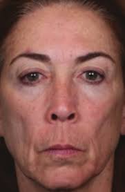 Impact of Comprehensive, Minimally Invasive, Multimodal Aesthetic Treatment 