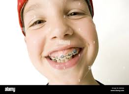 Grandi denti immagini e fotografie stock ad alta risoluzione