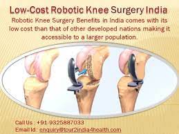 Knee Replacement Surgery What You Need To Know Knee Replacement Knee Replacement Surgery Knee Surgery