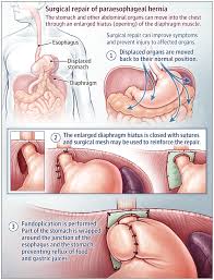 Pin On Patient Information Pages