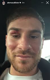 Quick macro photography shoot and equipment inquiry