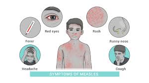 Image result for measles