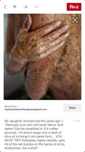 Pin By Jdeideh وير ار يو On Screenshots Beauty Solution Beauty Skin Care Beauty Hacks