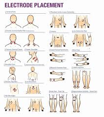 Electrode Pad Placement Chart Elegant Tens Unit Pads Google