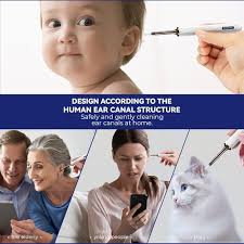 Amazon.com: Bebird Note3 Pro Kit de selección de endoscopio removedor de  cera de oído con cámara, otoscopio inalámbrico para eliminar cera de oído  con pinzas y punta compatible con teléfonos inteligentes iPhone, :