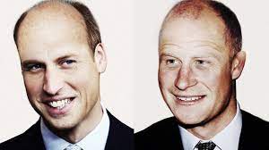 Er schließt sich nun ­genau wie sein bruder william und sein vater charles ­der prozession an. Prinz Harry Und Prinz William Haben Das Glatzen Gen Geerbt