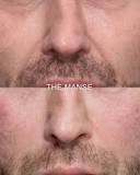 Image result